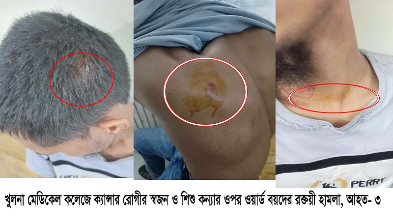 খুলনা মেডিকেল কলেজে ক্যান্সার রোগীর স্বজন ও শিশু কন্যার ওপর ওয়ার্ড বয়দের রক্তক্ষয়ী হামলা